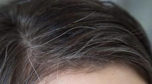 8个因素催生白发，快看你中了几个？中医的养发方法奉上，让白发晚点来