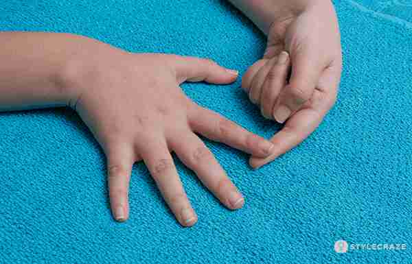手指僵硬、疼痛，多由这五种疾病导致！如何诊断治疗？医生告诉您